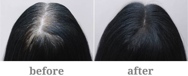 Beaver Hair Building Fibers, Μικρο-ίνες Φυσικής Κερατίνης κατά της Τριχόπτωσης & Αραίωσης των Μαλλιών 12γρ